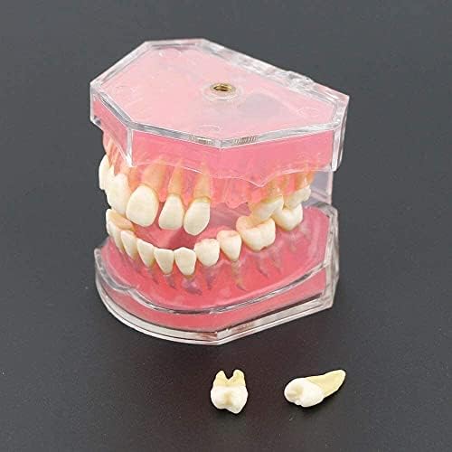 LumeCube LMEILI Стоматологичен Стандартен модел с Подвижни зъби Стоматологично Изследване на Обучение Модел